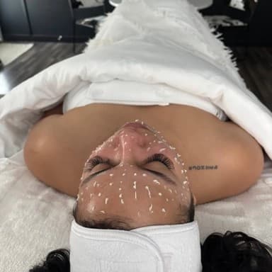 Cellstory Liquid Needling Package at Raw Aesthetics in Wasilla, AK